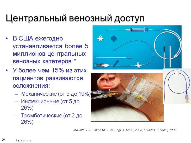 29 Центральный венозный доступ В США ежегодно устанавливается более 5 миллионов центральных венозных катетеров